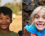kids missing teeth